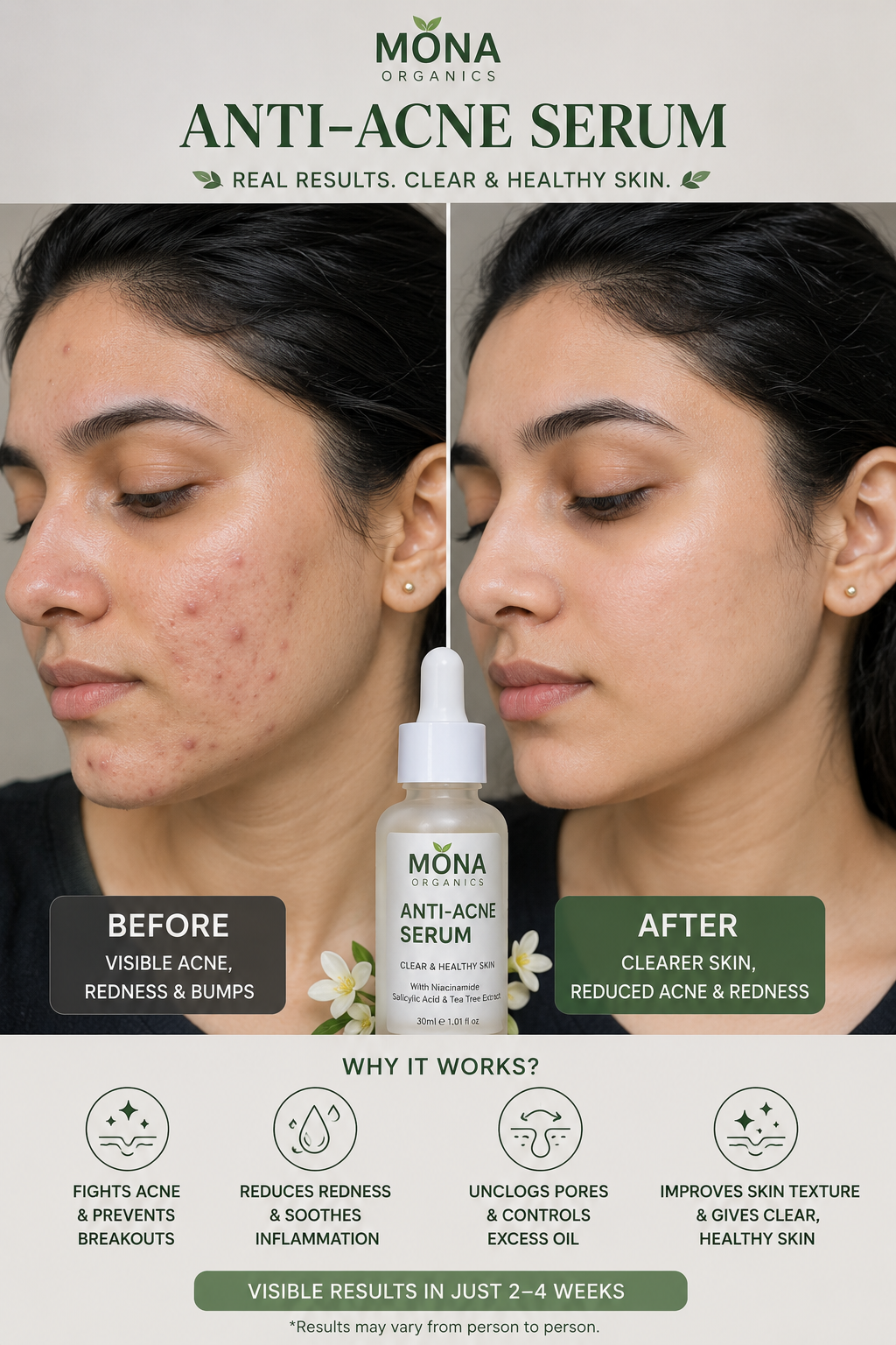 Anti Acne Serum