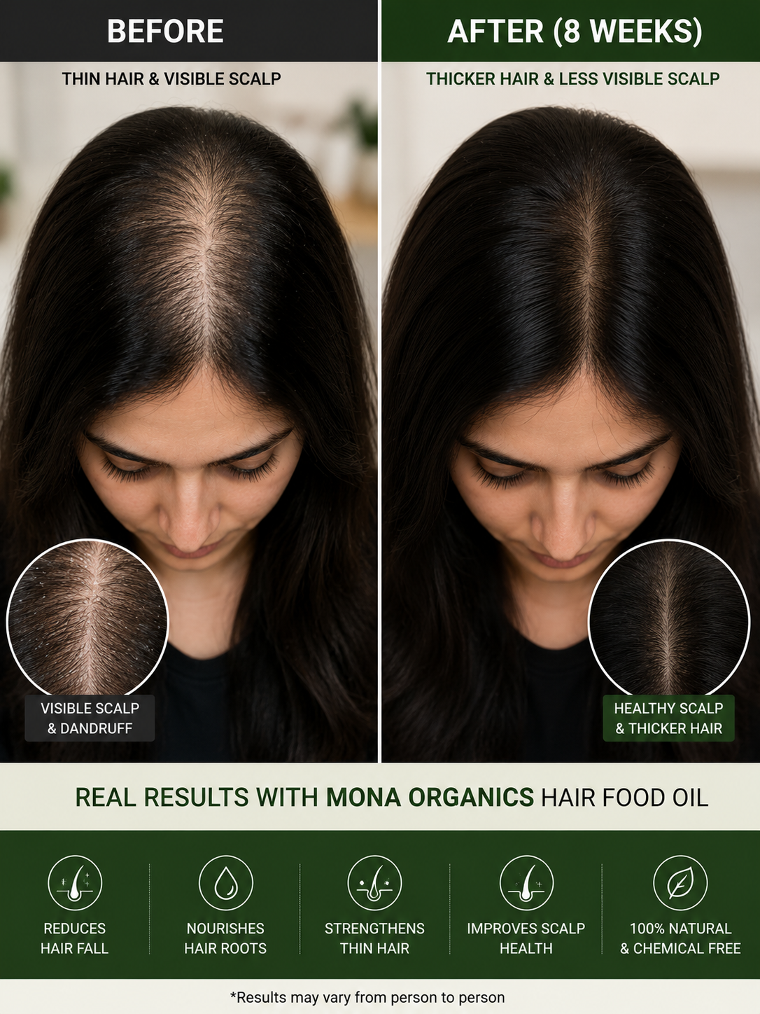 Hair Revival Kit