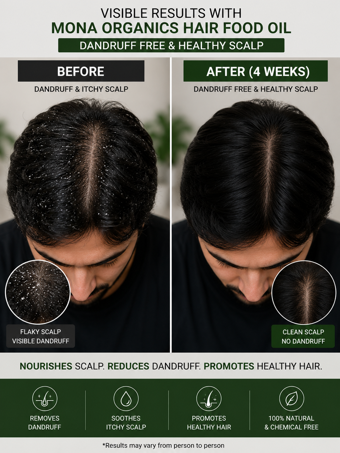 Hair Revival Kit